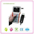 My-A016 Good Quality Handheld Veterinary Ultrasound Scanner for Sale